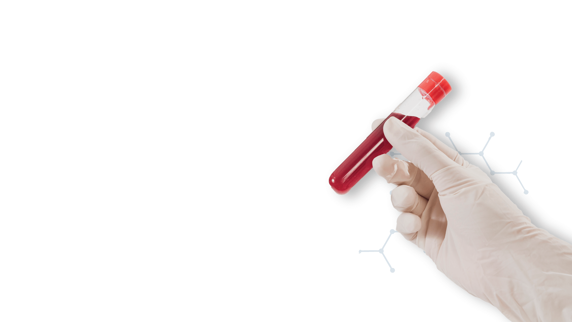 Micronutrient Testing The Woodlands Katy, TX