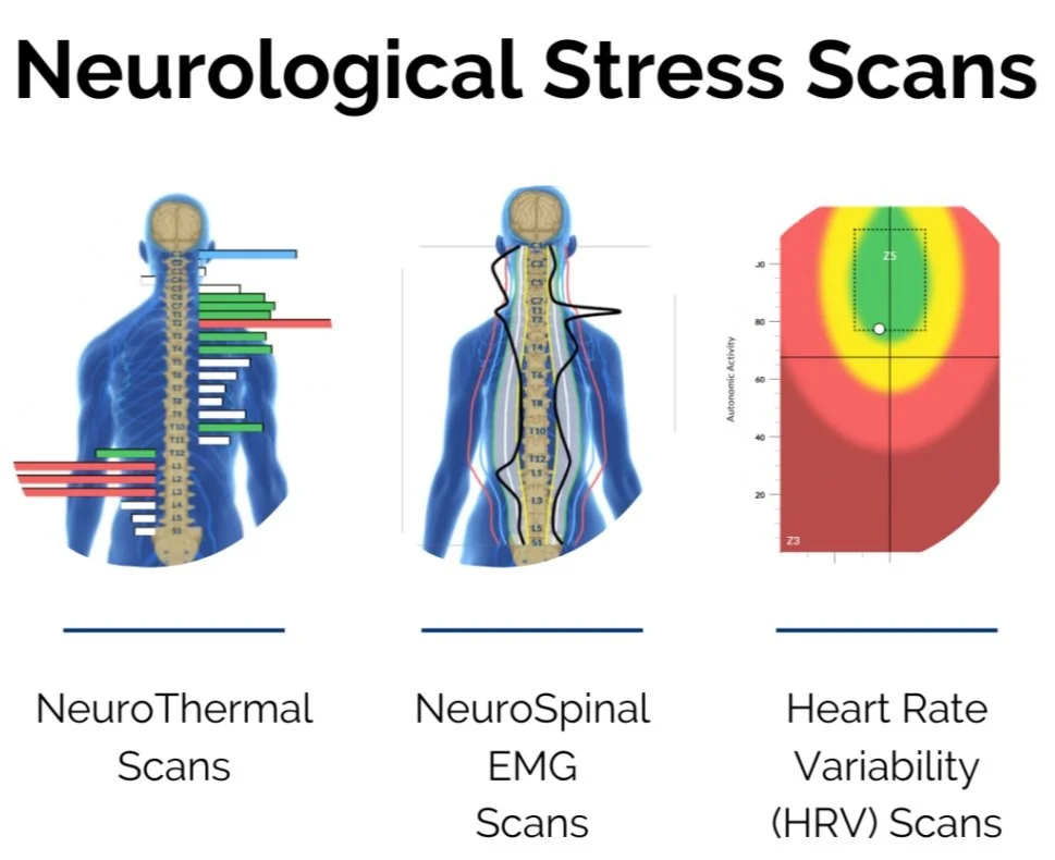 dysautonomia, nervous system, cla insight scan, best chiropractor Lafayette, best chiropractor near me