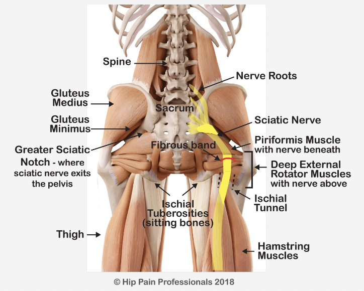 Why You Need Professional Pain Management for Your Sciatica