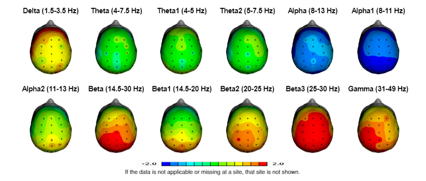 Brain Mapping and QEEG Assessment in Manhattan New York — Brain ...