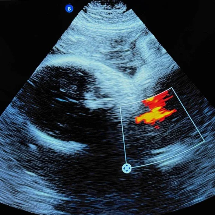 A Bright Tomorrow for Therapeutic Orphans: The Potential for New Approach Methodologies to Bridge Data Gaps for Pregnant Patients