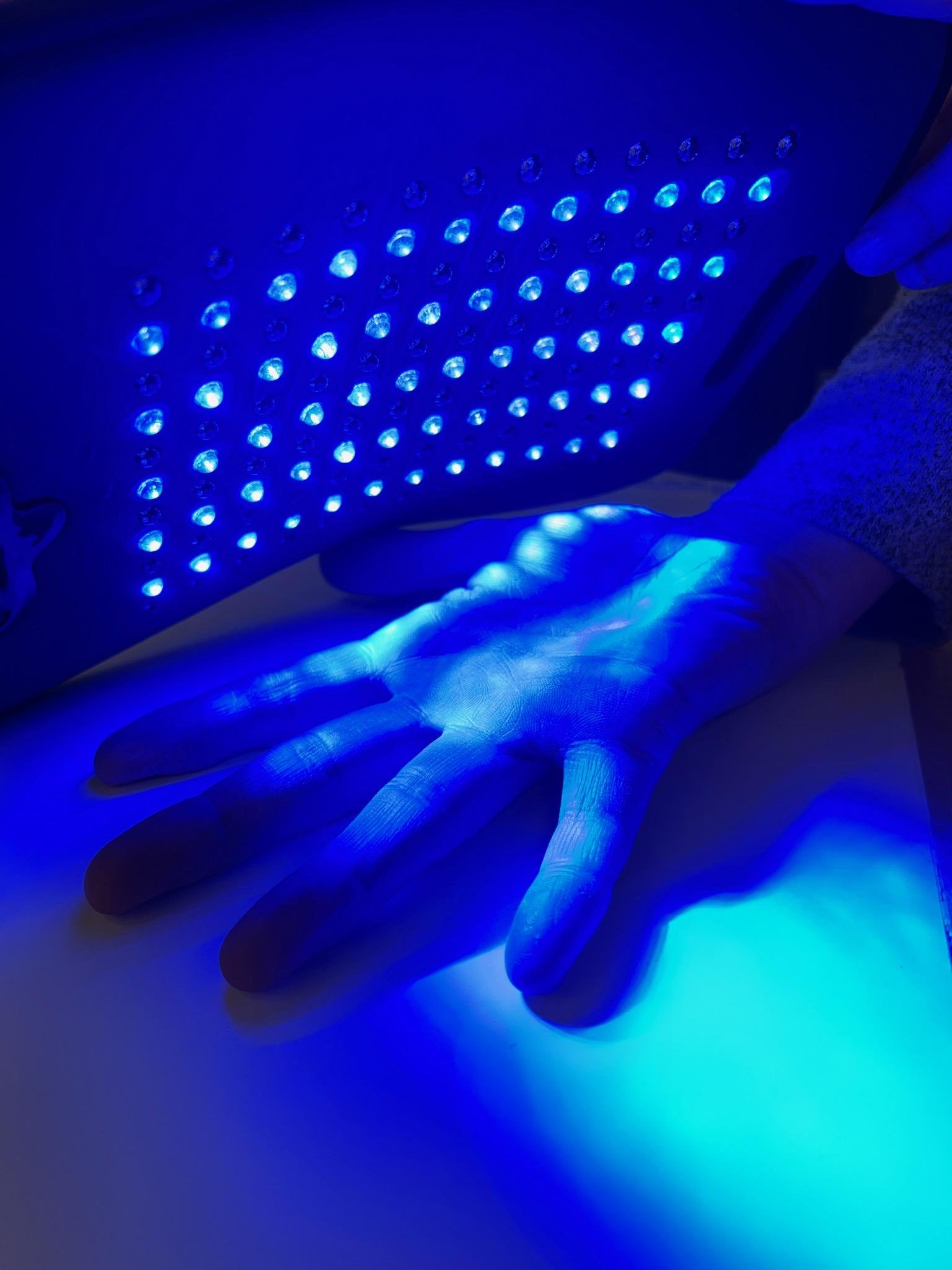 Blue light on hand.jpeg