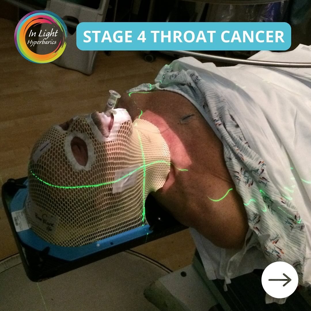 We&rsquo;ve seen an influx of people seeking help after chemo &amp; radiation therapy. This is something near and dear to my heart. I want to share my personal story of helping my dear husband Doug during his stage 4 throat cancer and how we helped h