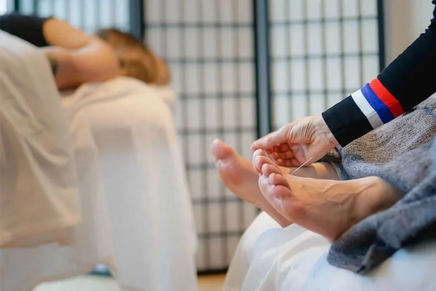 Community Acupuncture