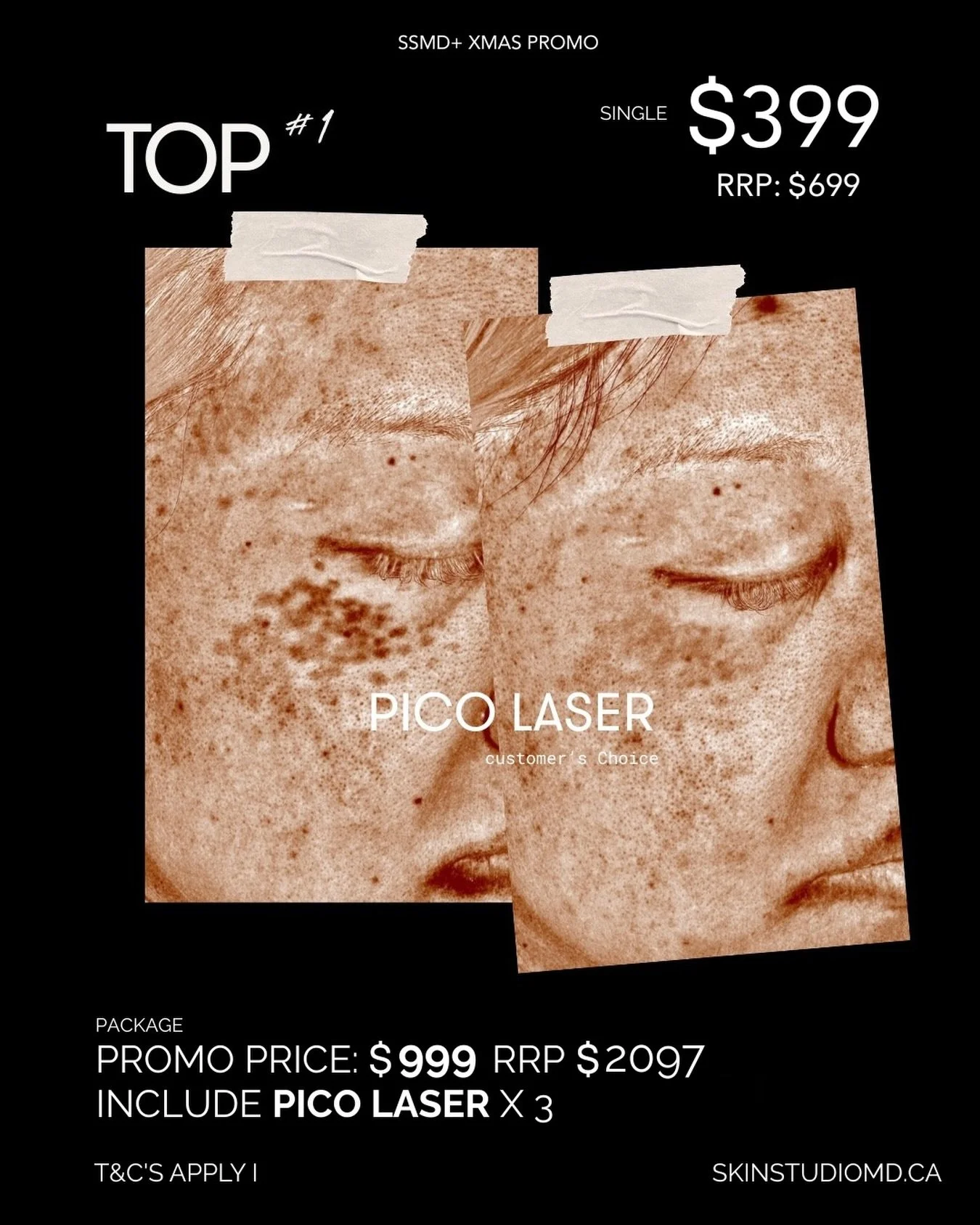 ✨ TOP #1 Client Favourite in Skincare Treatments ✨

Stubborn pigmentation? Sun spots? Freckles?
Our Pico Laser is the most-chosen treatment in 2025 by our clients for brighter, clearer skin 💫

🎄 Christmas Special
▫️ Single session: $399 (RRP $699)
