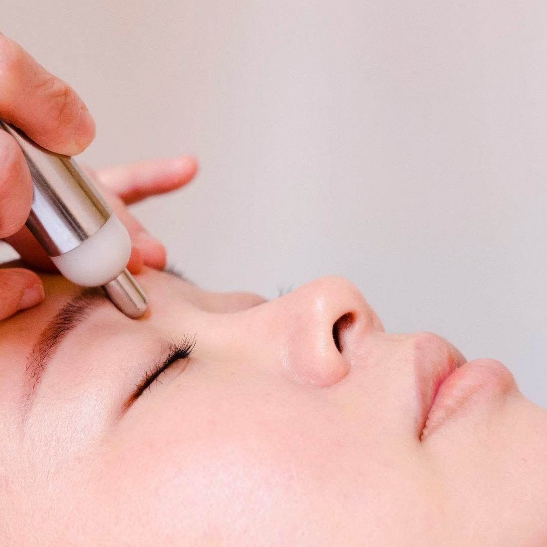 Person receiving a skin treatment with a metal tool on their forehead.