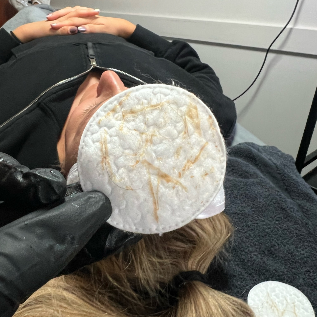 Dermaplane Vellus Hair Removal
