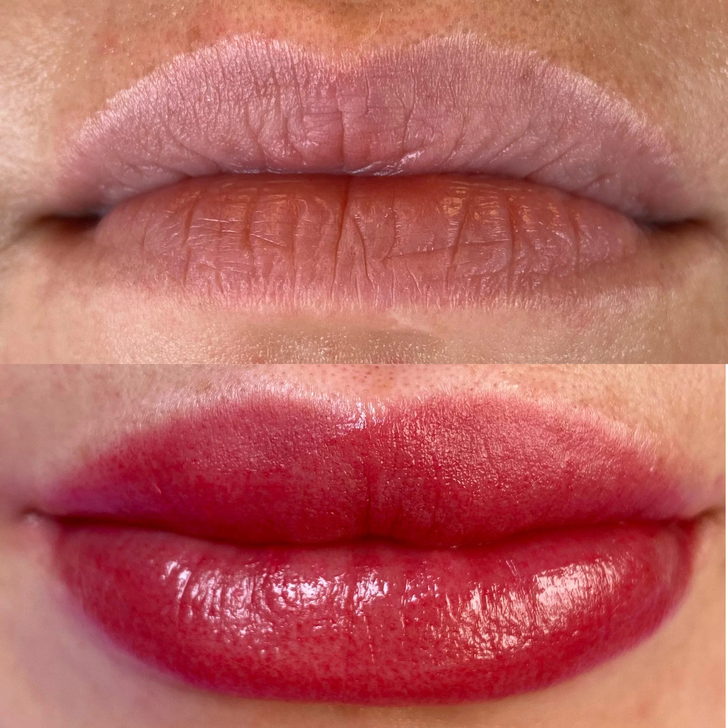 Lip Blush & Lip Shading Denver, CO — Denver Dream Medspa