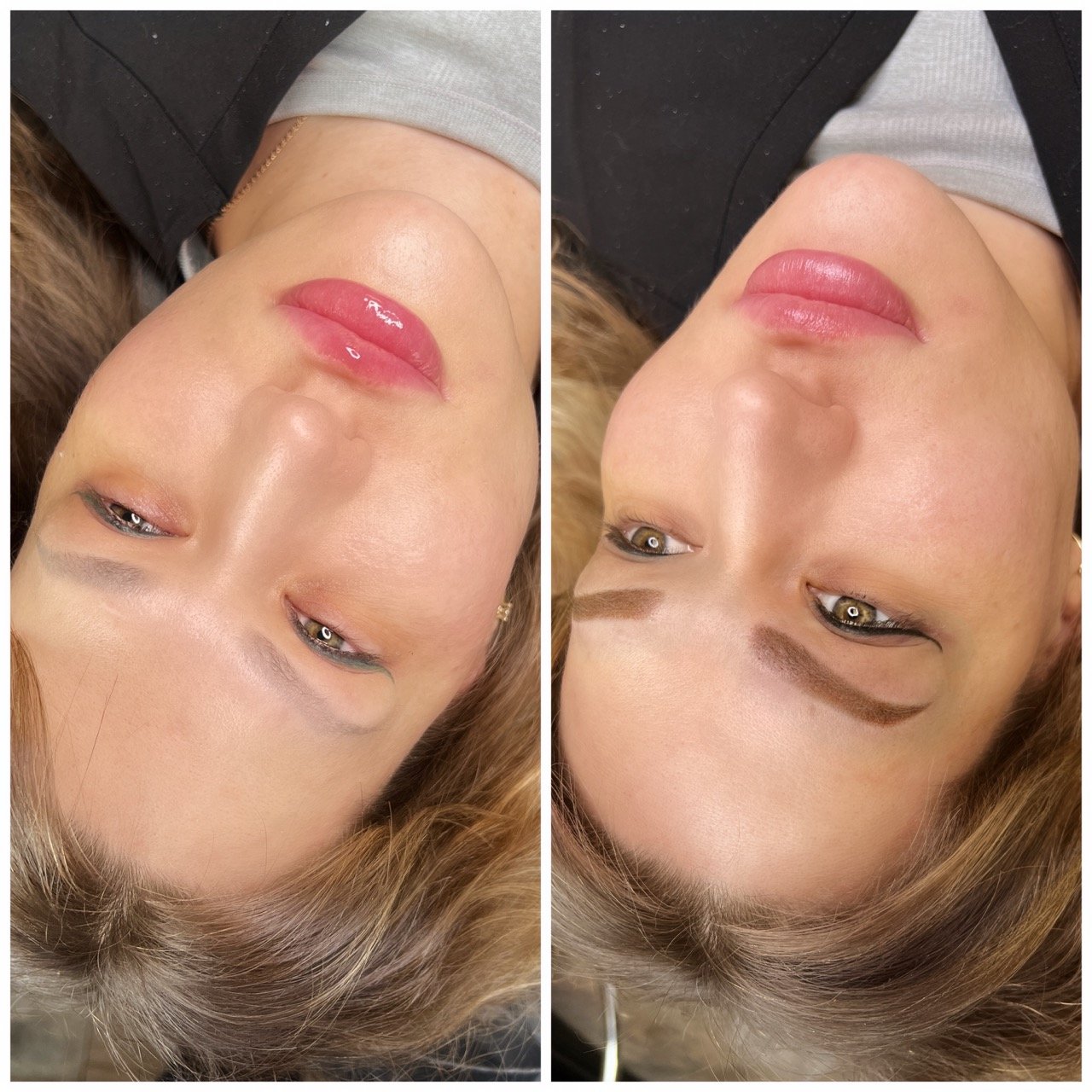 eyebrow correction in denver.jpeg