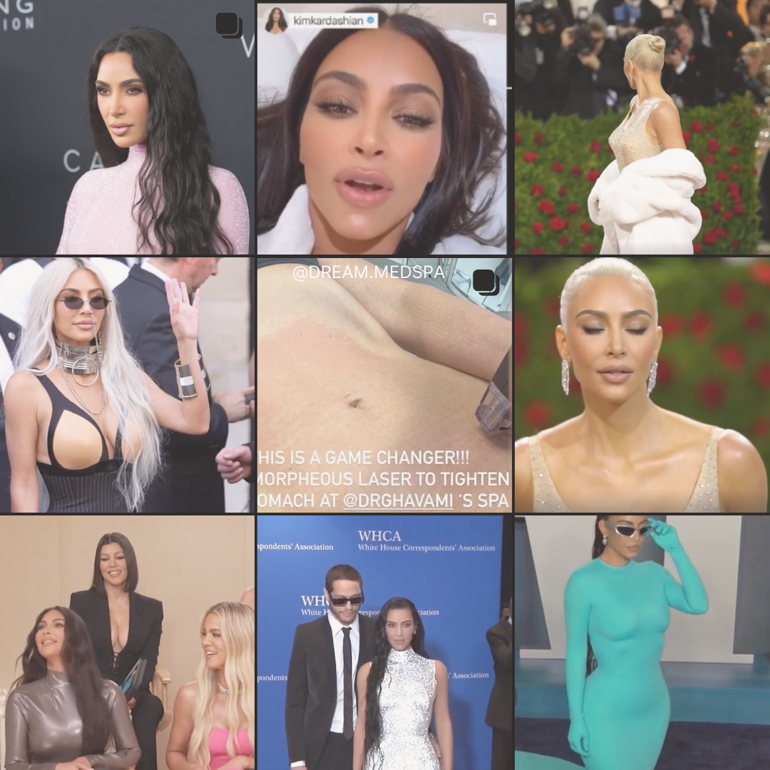 Kim Kardashian Morpheus8 Body Results
