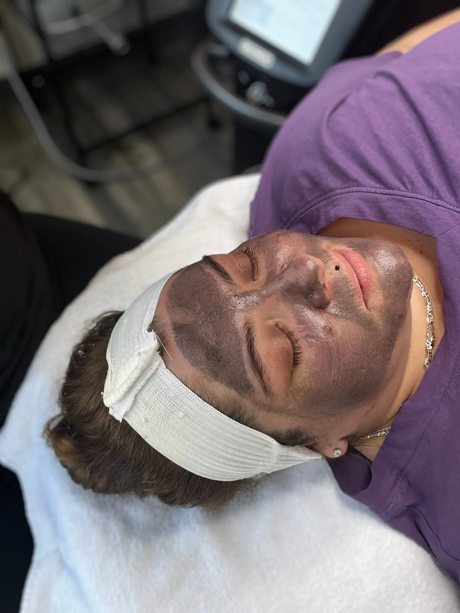 Hollywood Laser Glow Facial treatment at Denver Dream Medspa