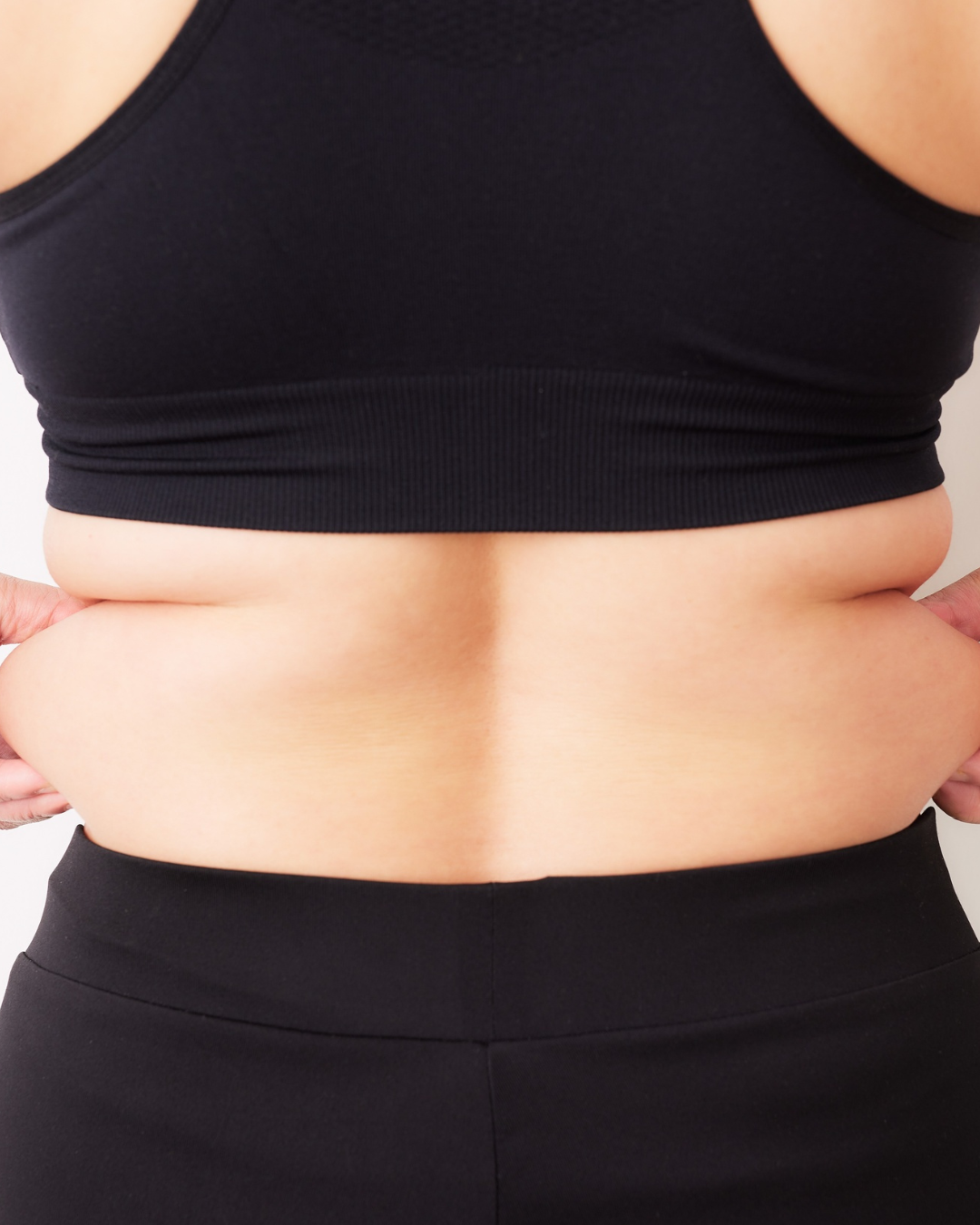 Morpheus8 Body for Cellulite: Smooth Your Skin