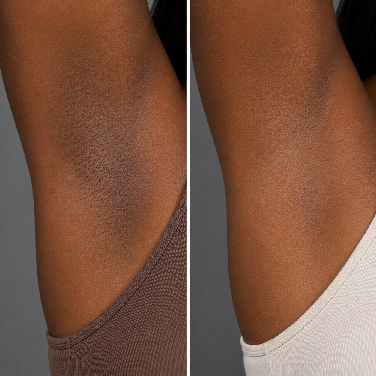 Side-by-side comparison of underarm skin: left side shows dark, hairy, and uneven skin; right side shows smooth, hairless, and evenly toned skin.