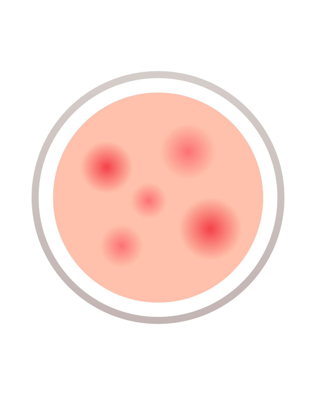 Lumecca IPL for facial redness and rosacea Denver