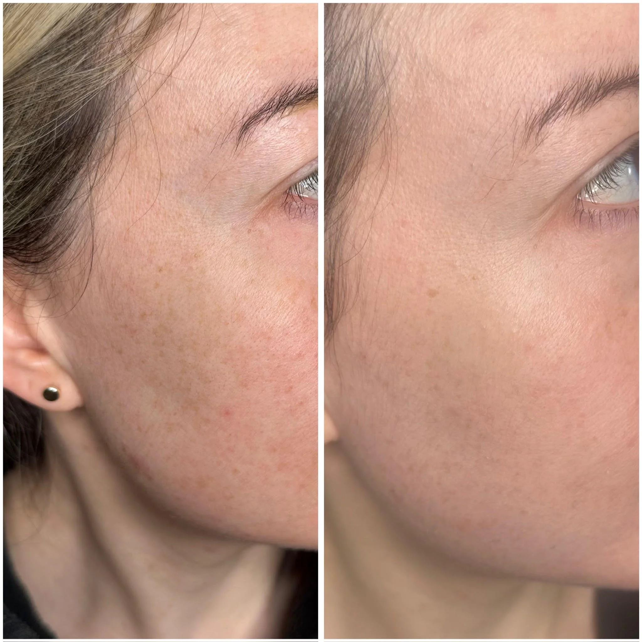 Close-up comparison of eyebrows before and after grooming or makeup application.
