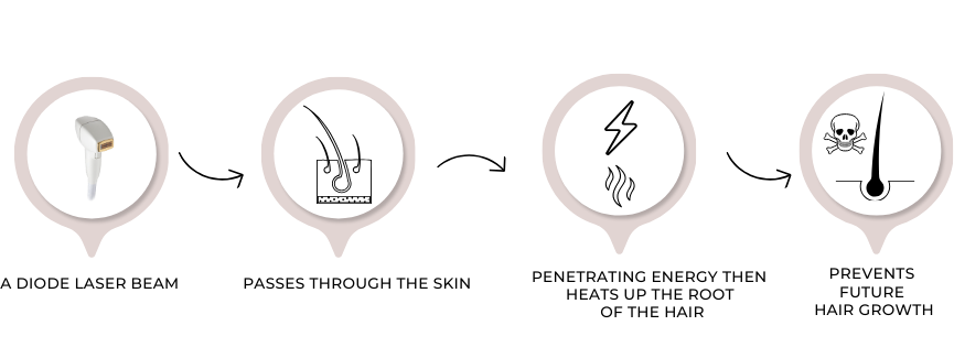 how a laser hair removal device works