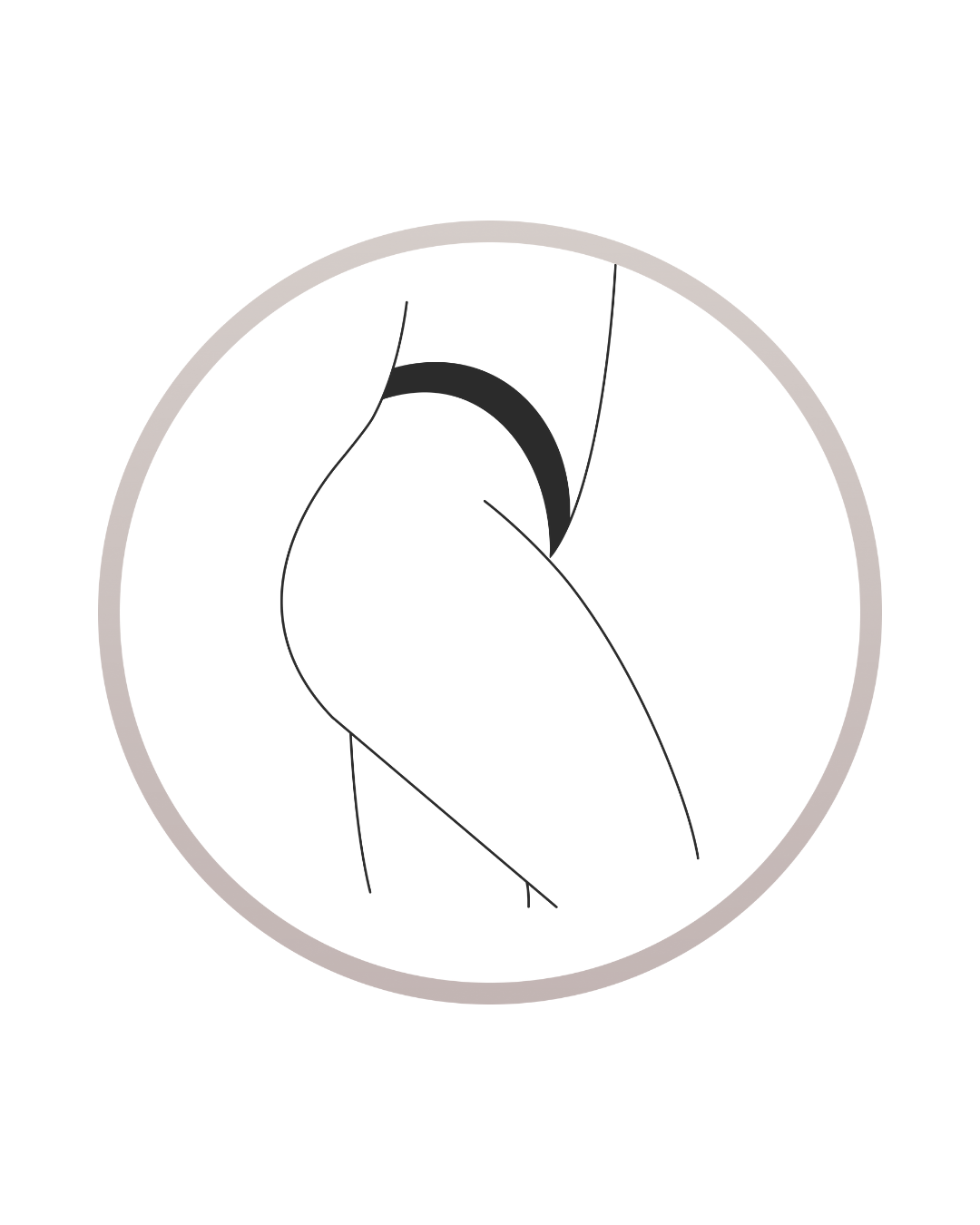 We treat buttocks with Morpheus8 Body at Denver Dream Medspa
