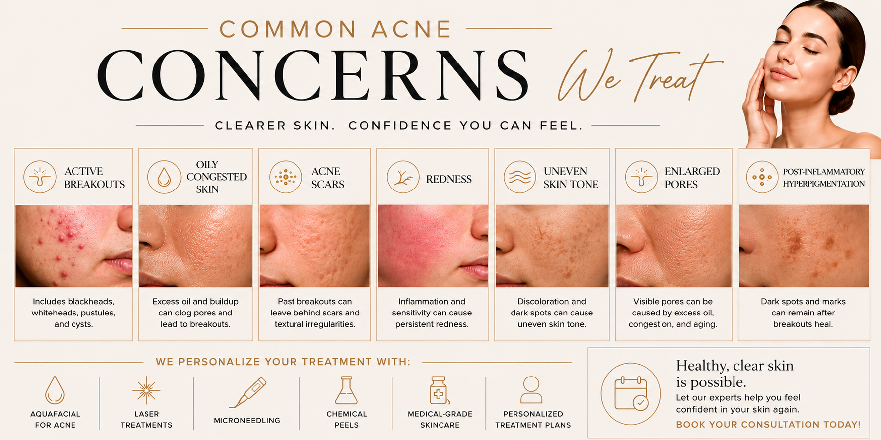 Infographic about common acne concerns, including active breakouts, oily congested skin, acne scars, redness, uneven skin tone, enlarged pores, and post-inflammatory hyperpigmentation, with descriptions and treatment options like aquafacial, laser treatments, microneedling, chemical peels, medical-grade skincare, and personalized treatment plans.