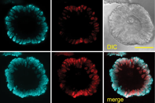 New publication by the Rodriguez-Colman lab