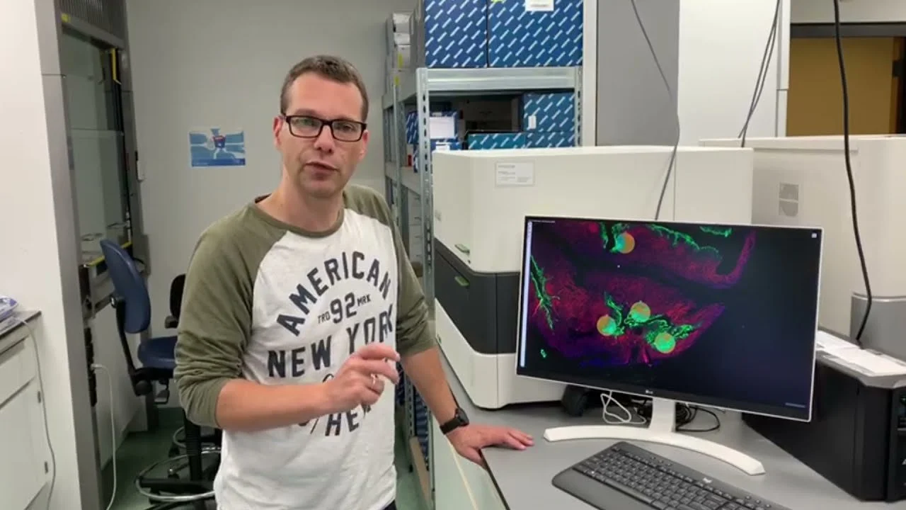 Interview with Ies Nijman on the intellectual property battle in spatial transcriptomics technology