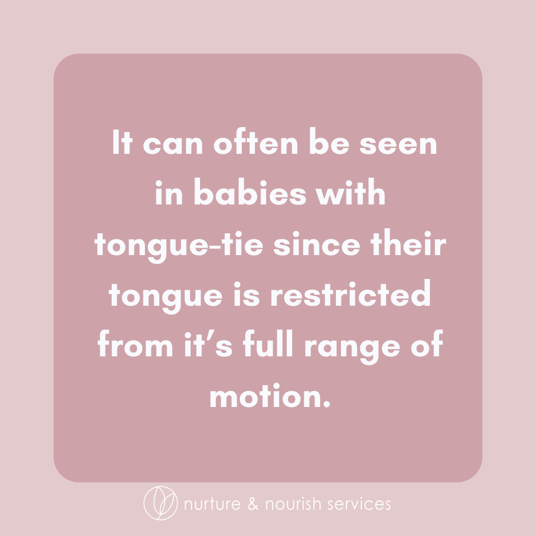 29 tongue tie release.png