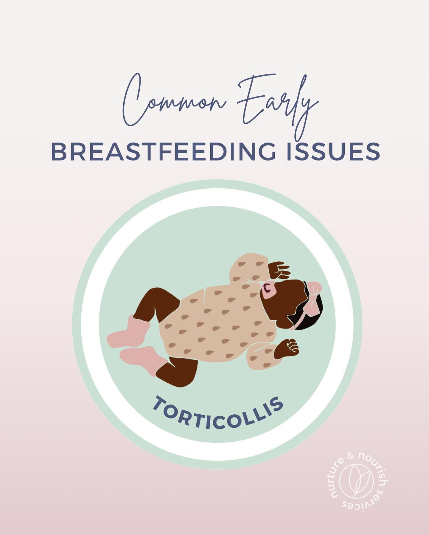 Breastfeeding at the beginning has a learning curve.&nbsp; There are common problems that tend to arise in the early days of feeding. Let's talk about a common challenge that can arise during breastfeeding: torticollis. Torticollis is a condition whe