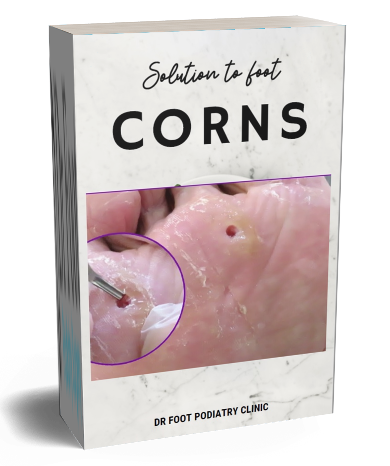 A book titled "Solution to foot corns" with a cover photo showing a close-up of a foot with a corn and a medical procedure on the corns, issued by Dr. Foot Podiatry Clinic.