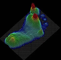 Forefoot Pain