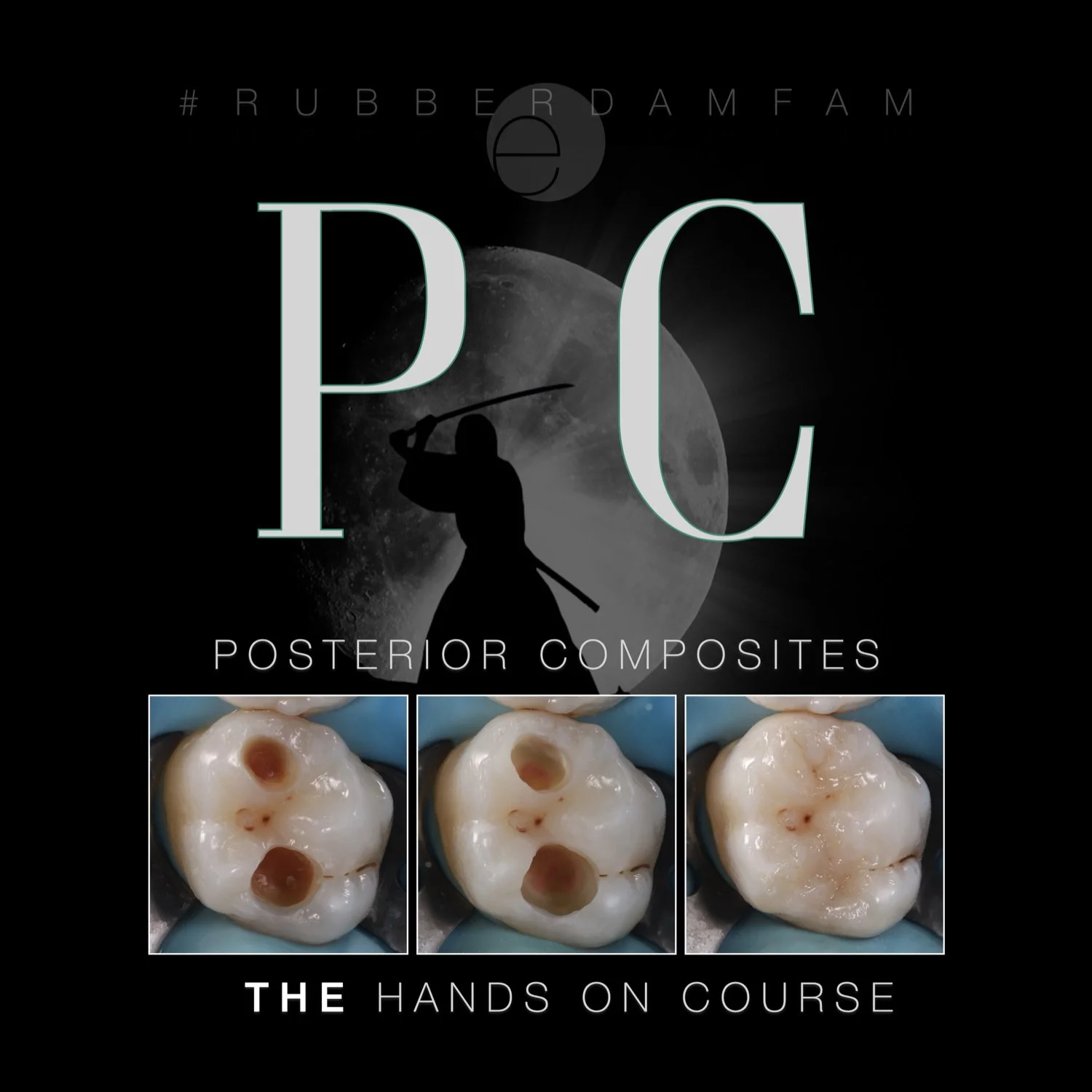 PC - THE posterior composite course