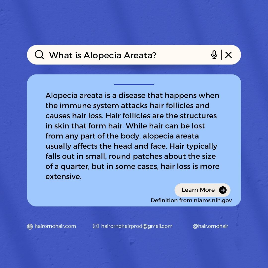 Never heard of Alopecia before? Well we&rsquo;re here to give y&rsquo;all a bit of a definition for Alopecia Areata. This type of alopecia is one that our main character Bel Davis has been living with for years.