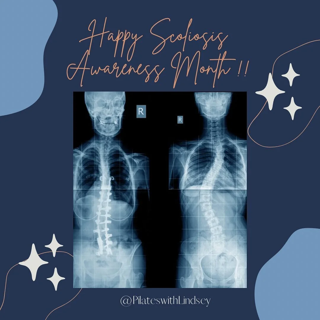 💙 Happy Scoliosis awareness month!!💙 I was diagnosed with scoliosis as a teenager and was braced due to the degree of my curve, but not given exercises or many tools for management at the time. This area continues to be an area of interest for me w