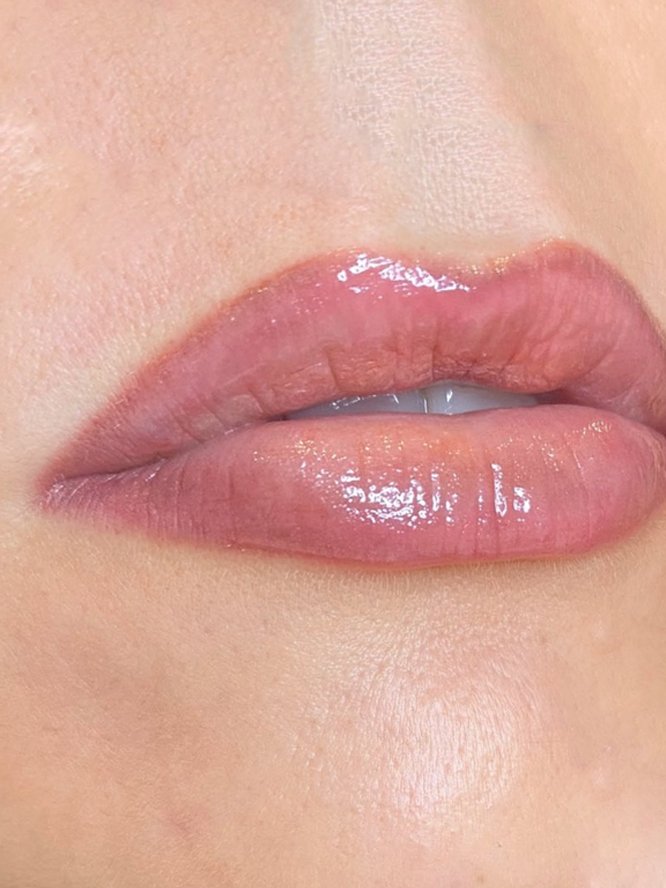 K+MU - PMU TREATMENTS2.jpg