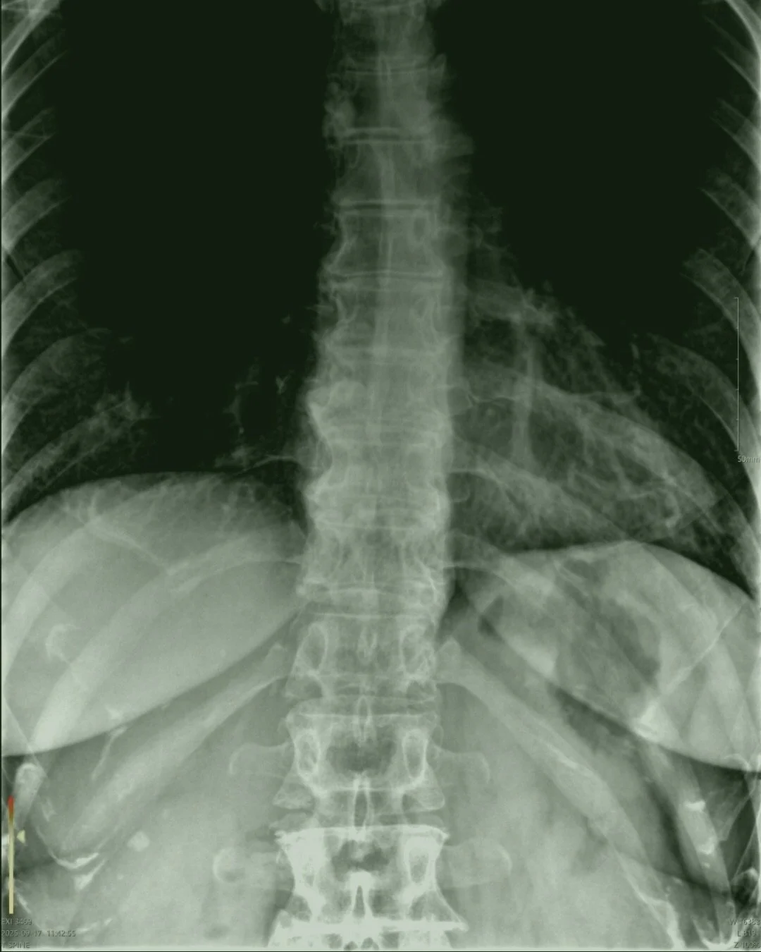 &ldquo;The chiropractor looked at my X-ray and said, &lsquo;you don&rsquo;t have scoliosis now.&rsquo; I just smiled and said, &lsquo;It&rsquo;s all the yoga.&rsquo;&rdquo;

When a student shares something like this, it reminds us of the greatest gif