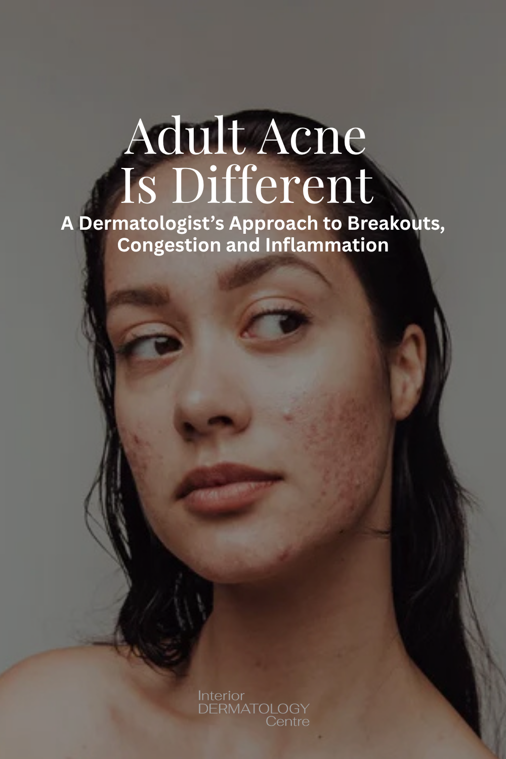 Adult Acne Is Different: A Dermatologist’s Approach to Breakouts, Congestion, and Inflammation