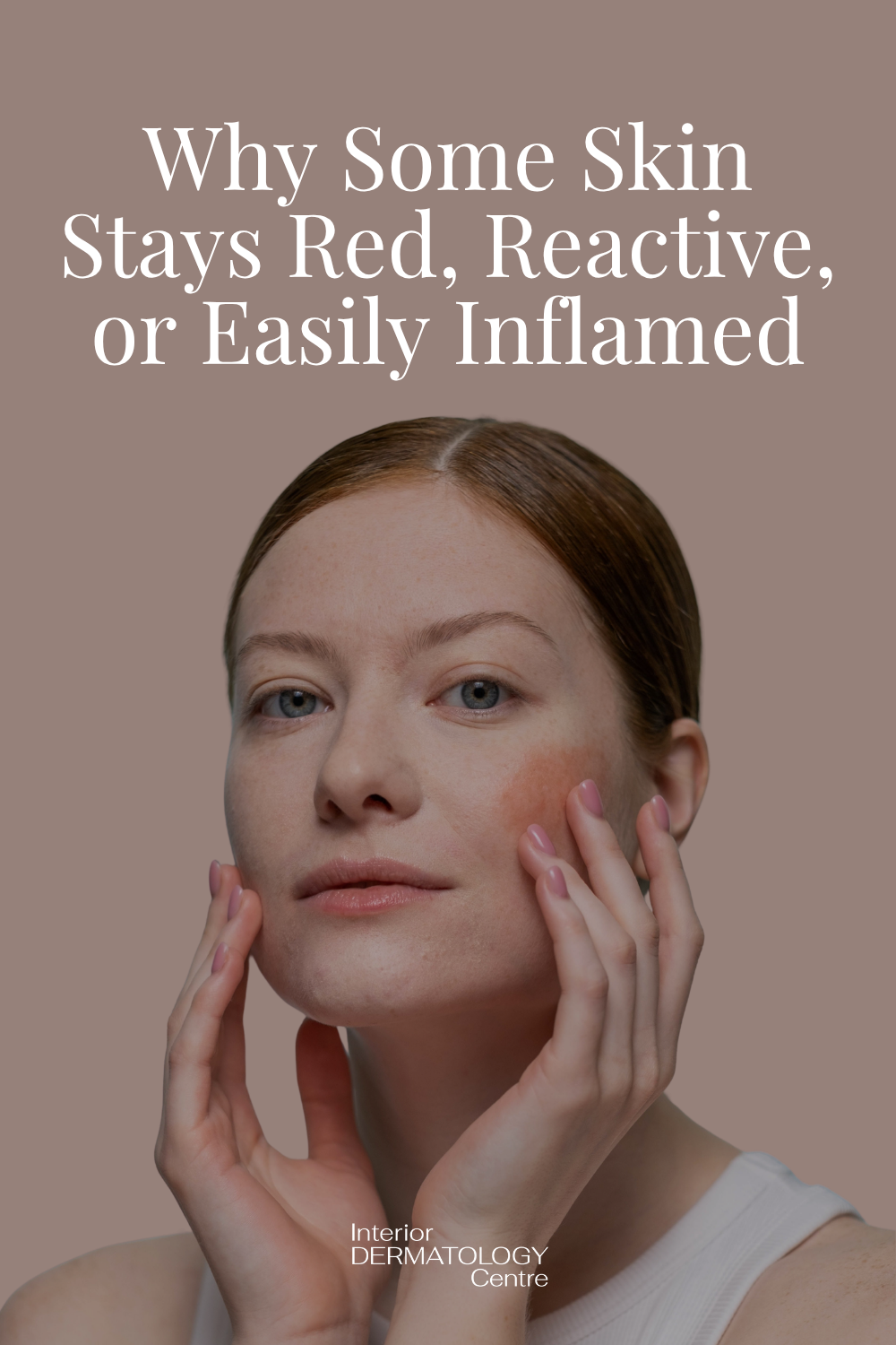 Why Some Skin Stays Red, Reactive, or Easily Inflamed