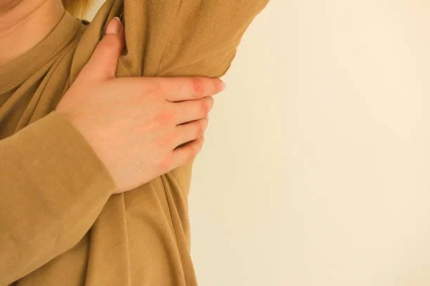 Hidradenitis Suppurativa - Interior Dermatology Centre