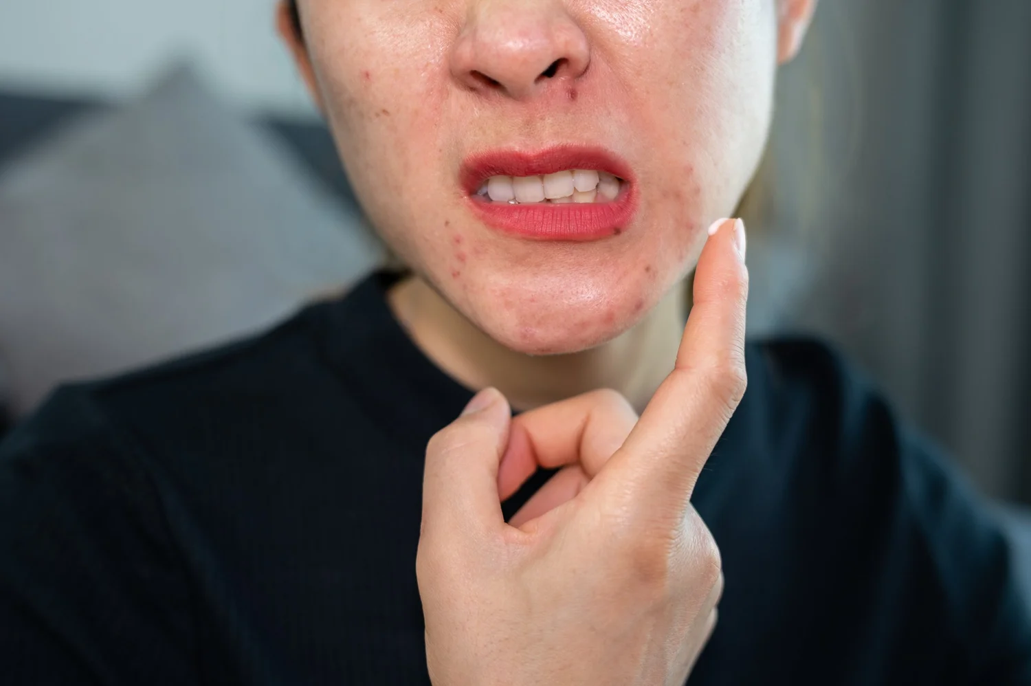 Acnetop Acne: Top Tips and Busted Myths | Interior Dermatology Centre