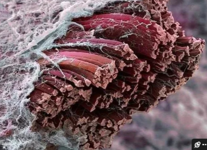 Ammonia Build Up from Parasite Die Off: Benefits of Ornithine, Arginine, and Lycopene.