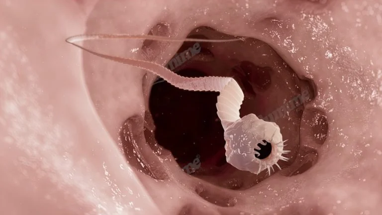 Parasites: The Public‑Health Crisis Flying Under the Radar