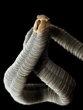 Are Doctors Downplaying Parasitic Infections? The Evidence Says Yes!