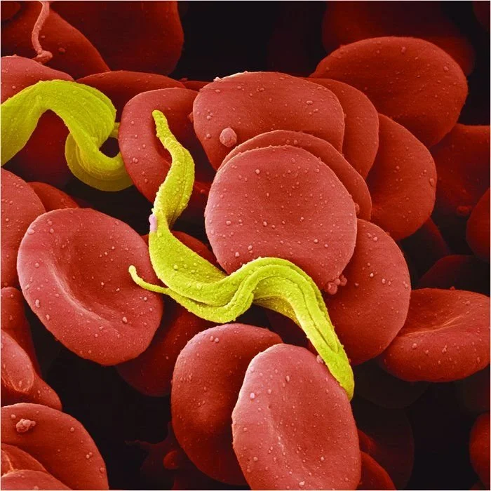 The Restless Invader (African Trypanosoma brucei)