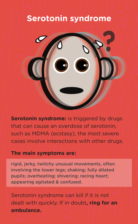 serotonin syndrome pupils