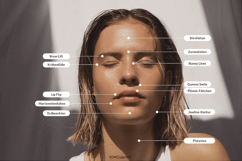 Übersicht möglicher Botox®-Behandlungsbereiche im Gesicht und am Hals