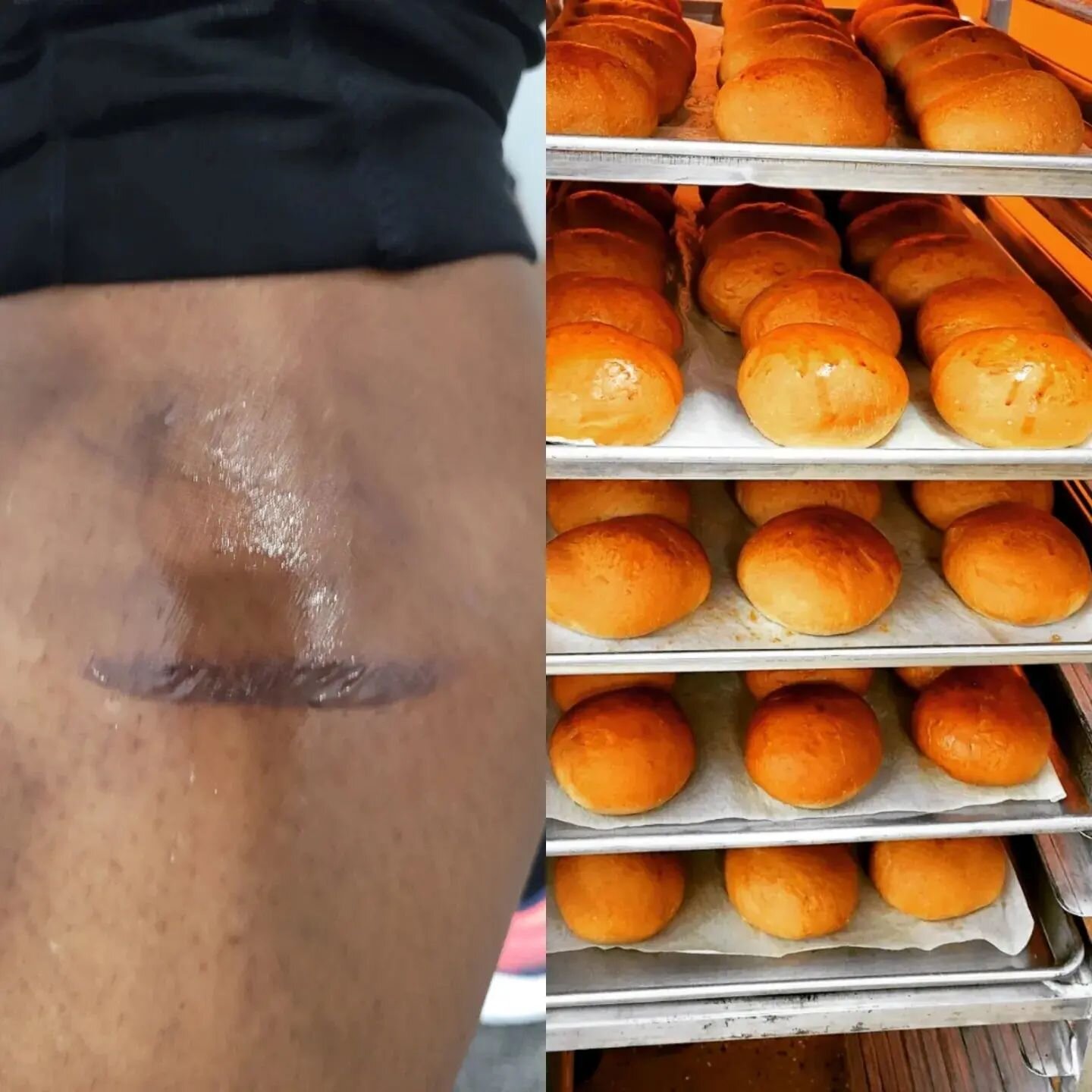 It's not all fun and games in the kitchen 
.... &quot;I volunteer as tribute&quot; to the bun gods .... sacrifice for the greater good of these beautiful masterpieces .... yes, it hurt but I've done worse .... 😫 

I hit my calf on a sheet tray, it h