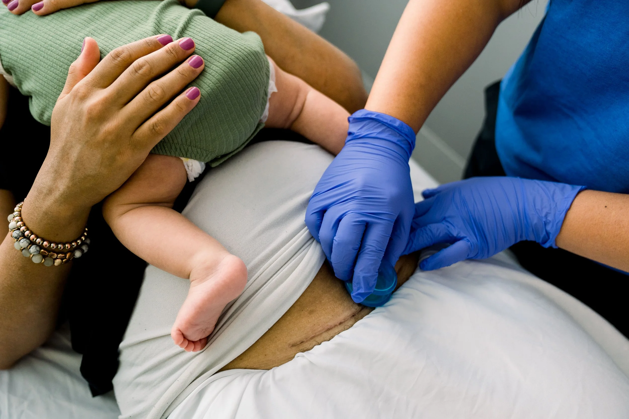 Cupping a mother's cesarean scar with the baby on her belly to improve fascial tension on c section scar for scar management at Flourish Pelvic Health & Wellness in Philadelphia PA