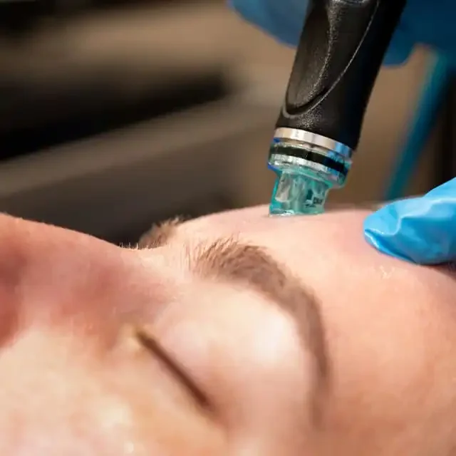 hydrafacial.jpg.webp