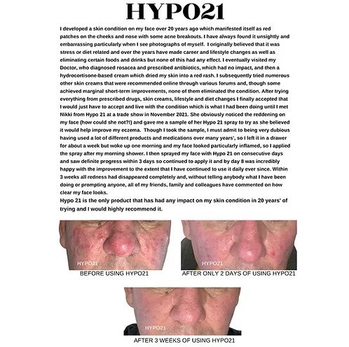 HYPO21 Purifying Skin Spray Testimonail.jpeg