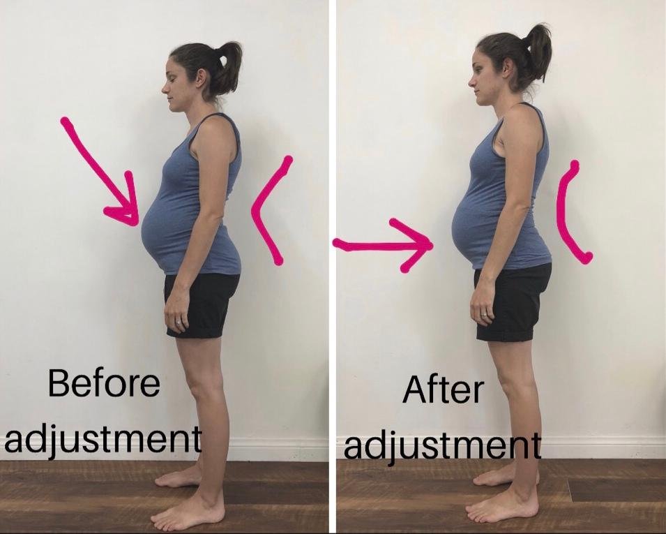 ster Technique during Pregnancy — Blooming Chiropractic Costa Mesa
