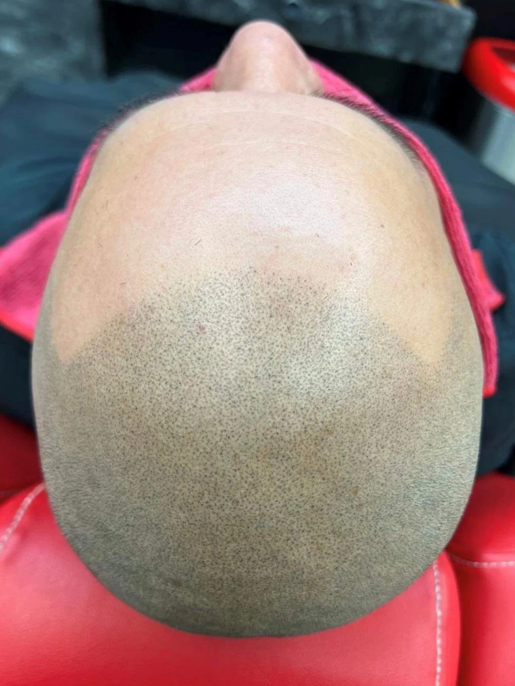 scalp.jpg