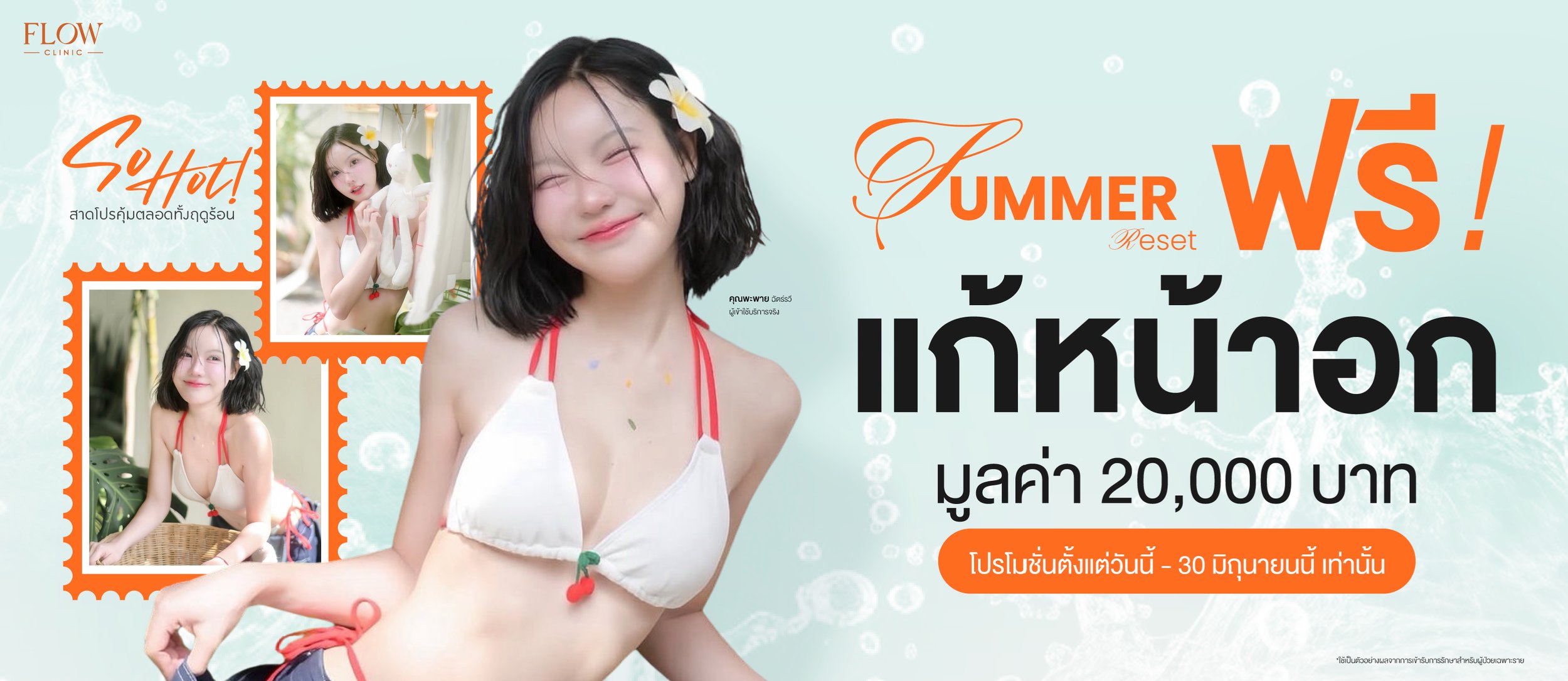 Summer Reset ปรับใหม่ให้มั่นใจอีกครั้ง กับโปรฟรีแก้หน้าอกมูลค่า 20,000 บาท&nbsp;ตั้งแต่วันนี้ - 30 มิถุนายน 2569